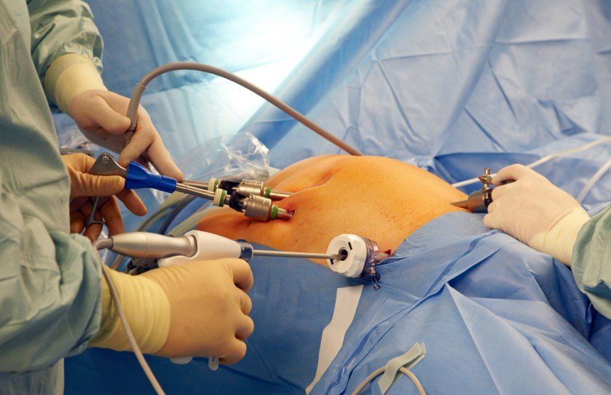 Know about Laparoscopy