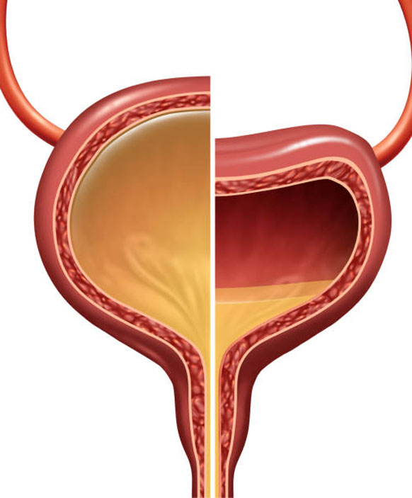 Overactive Bladder: All You Need To Know