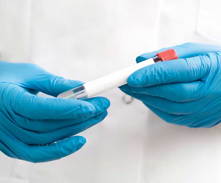 PSA Screening / Test – What, Why & When?