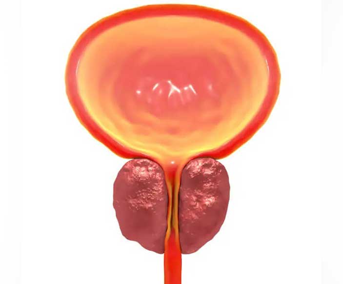 प्रोस्टेट की वृद्धि के लिए सर्जिकल विकल्प: आपको क्या जानना चाहिए